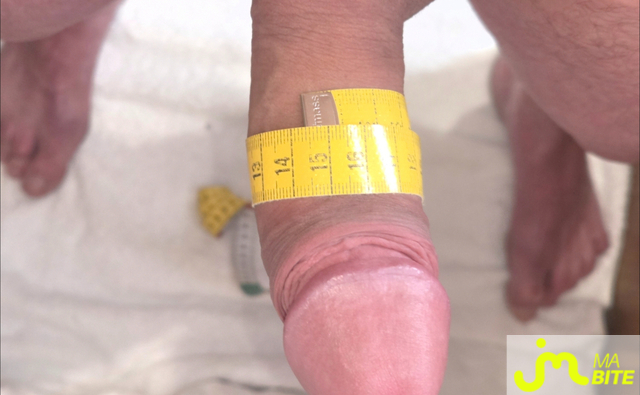 bites de Incognito14