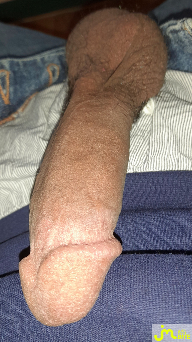 bites de Ericoup&eacute; 