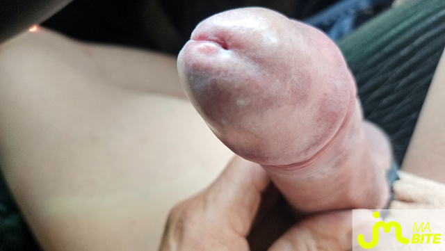 bites de Calou31