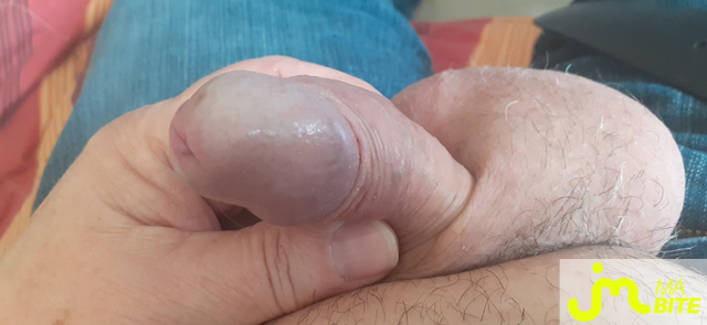 bites de denis 38000