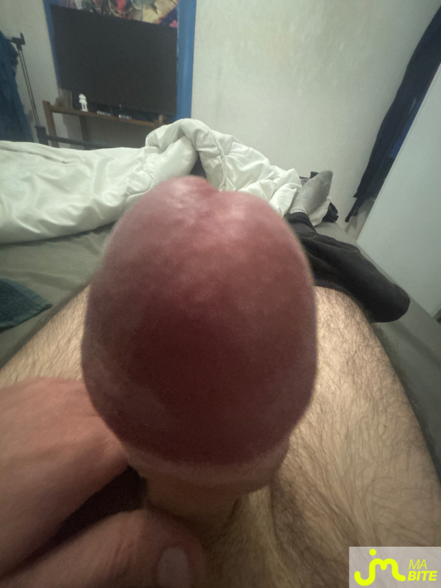 bites de Ziodinamite