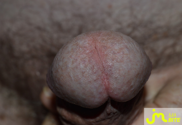 bites de biloute5962