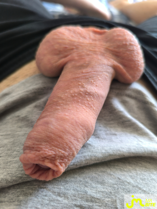 bites de Coucou_Ouep