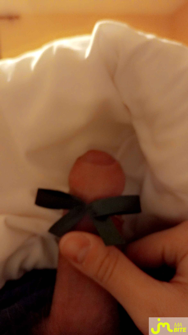 bites de DiscordCutie