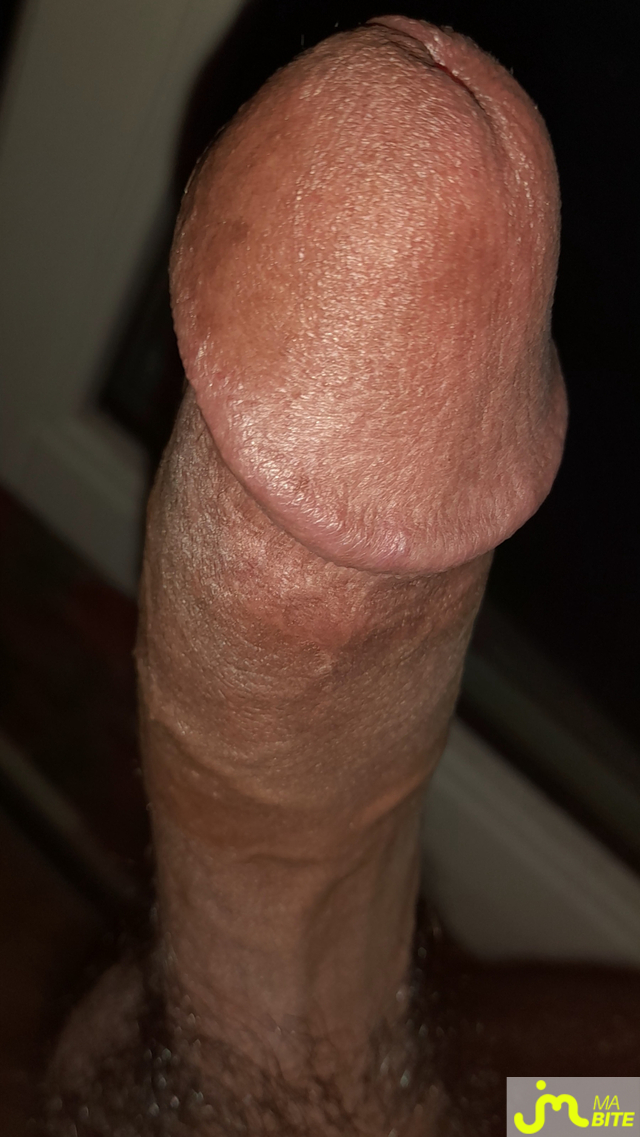 bites de Ericoup&eacute; 