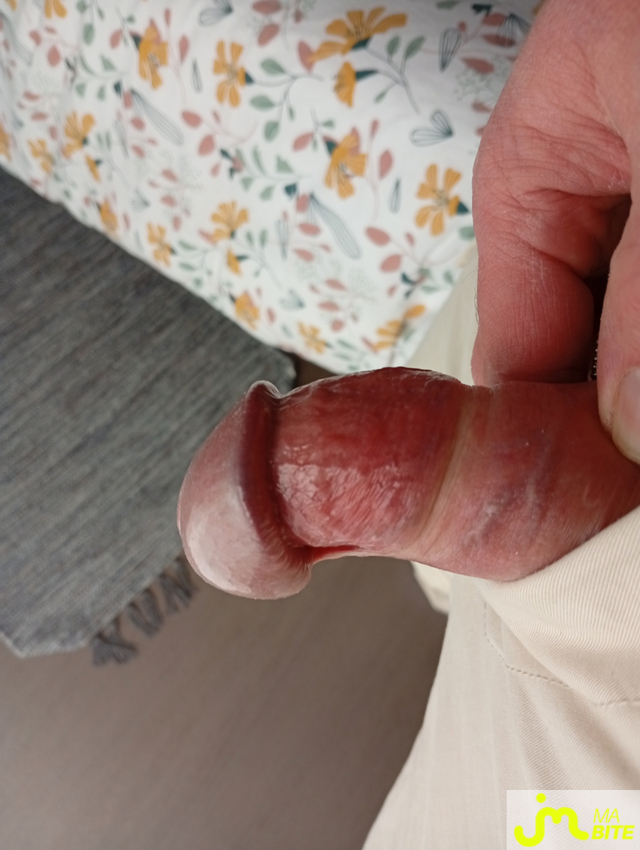 bites de Castration83