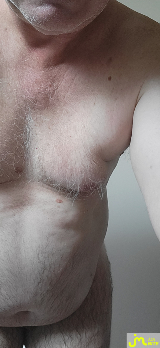 bites de murbitemole