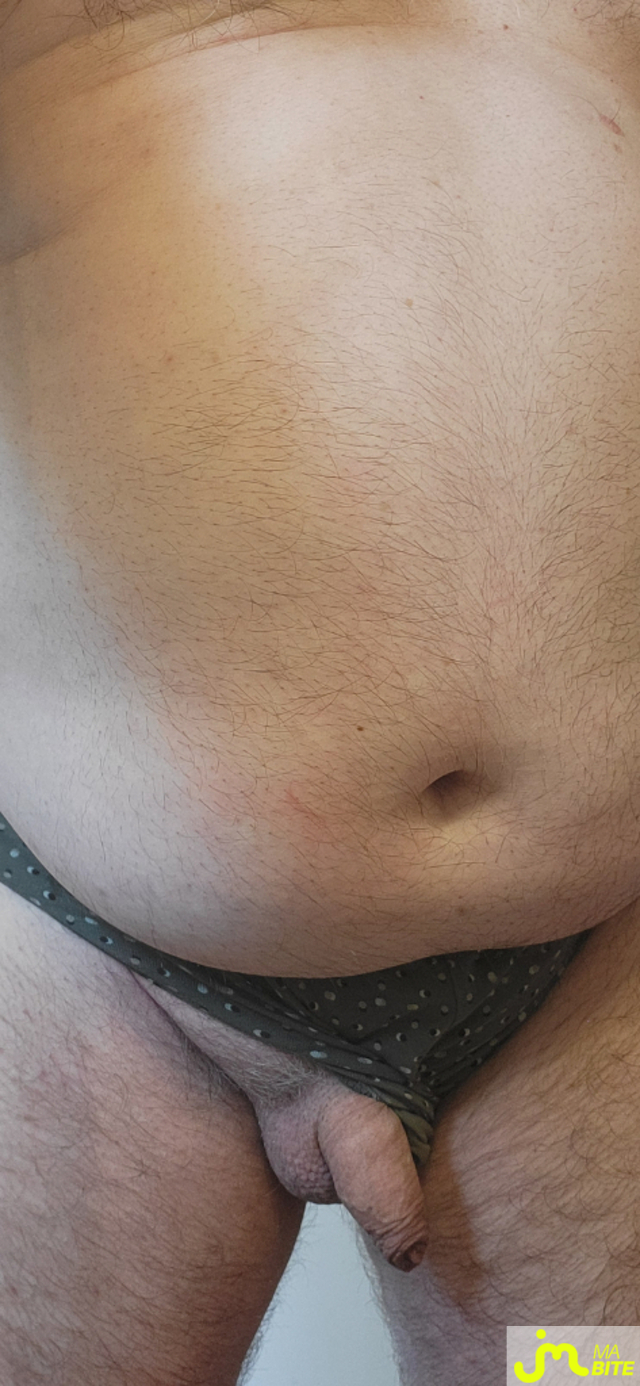 bites de murbitemole