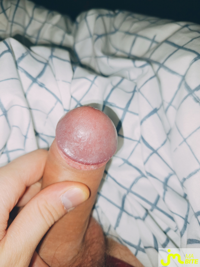 bites de DiscordCutie