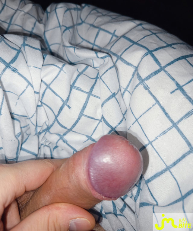 bites de DiscordCutie