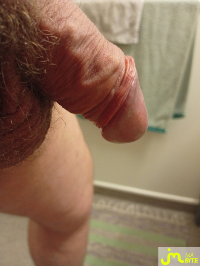 bites de Castration83