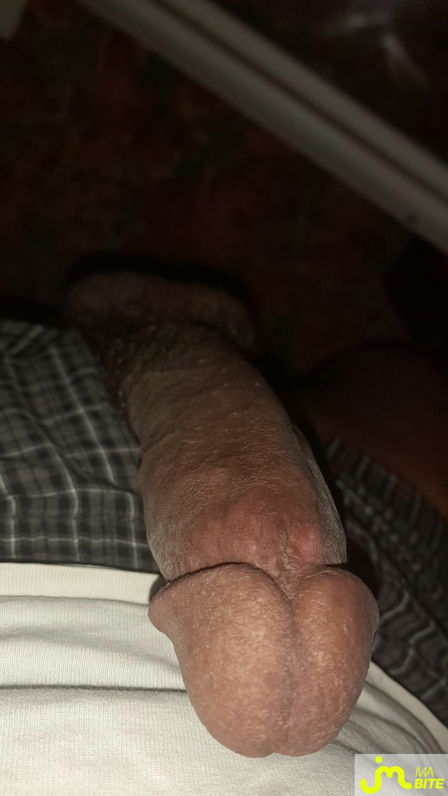 bites de Ericoup&eacute; 