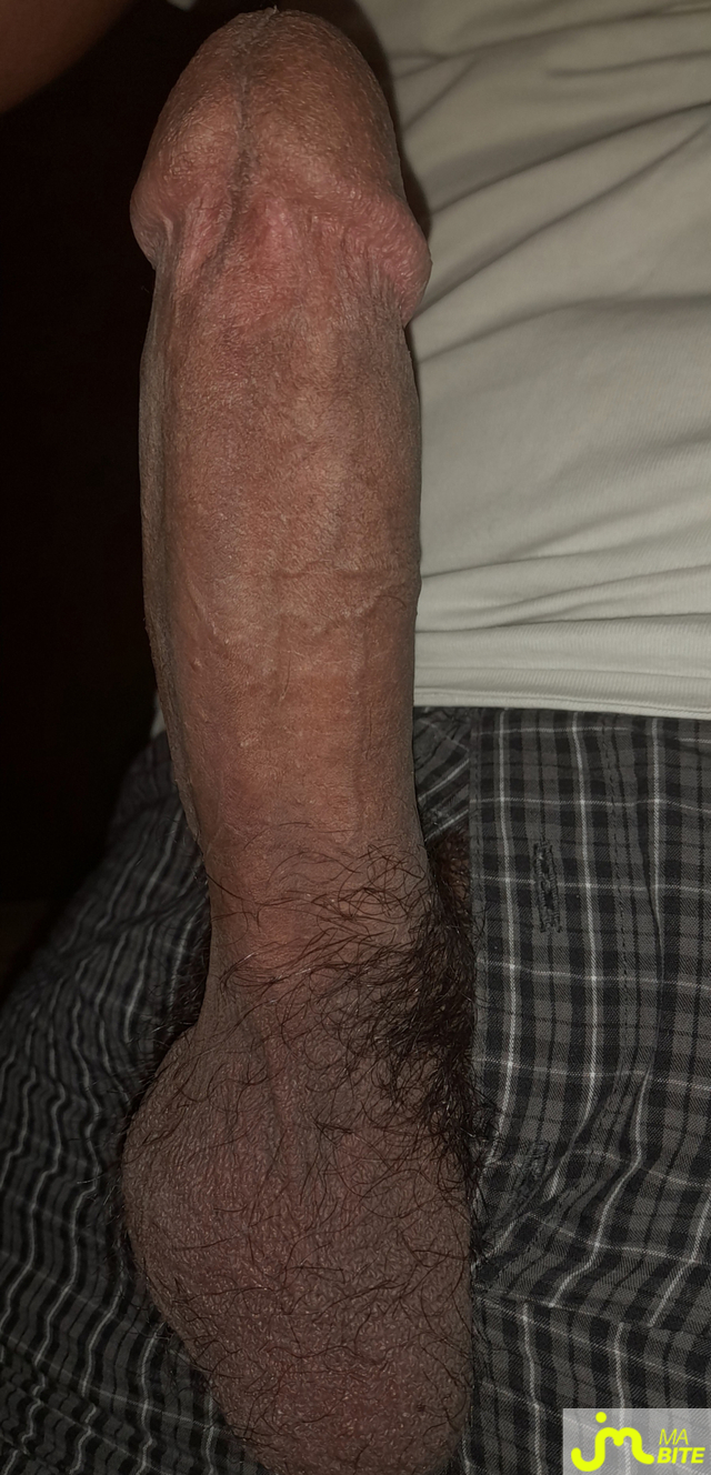 bites de Ericoup&eacute; 