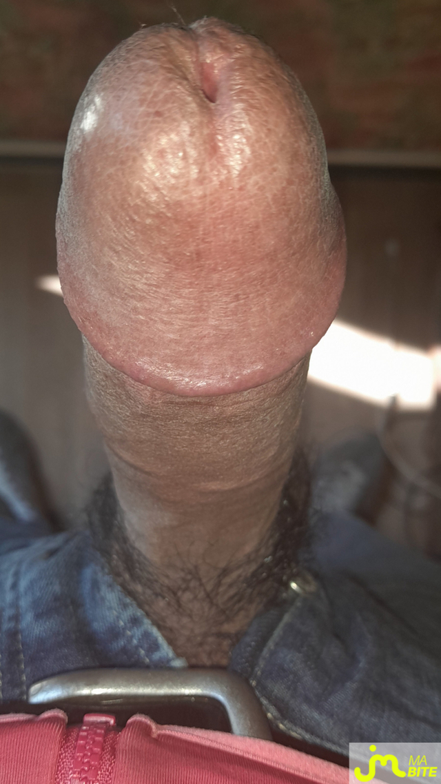 bites de Ericoup&eacute; 