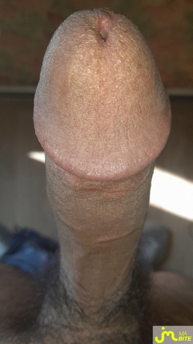 bites de Ericoup&eacute; 