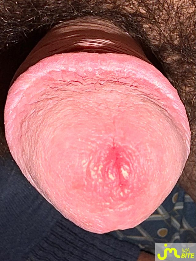 bites de Suceusedu31