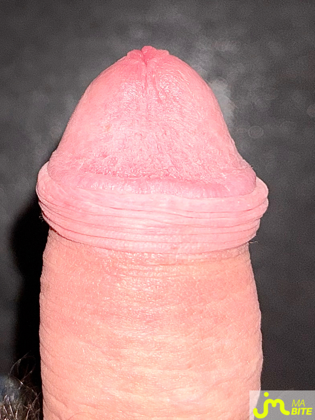 bites de Suceusedu31