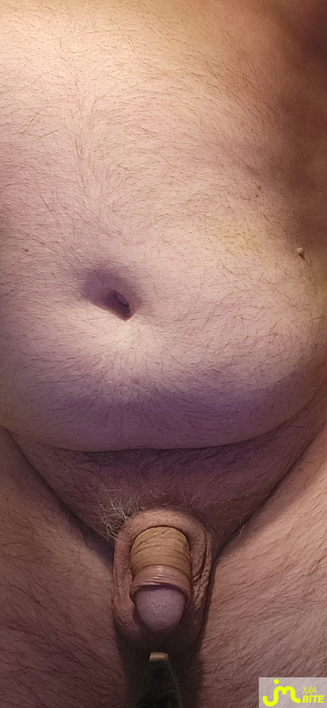 bites de murbitemole