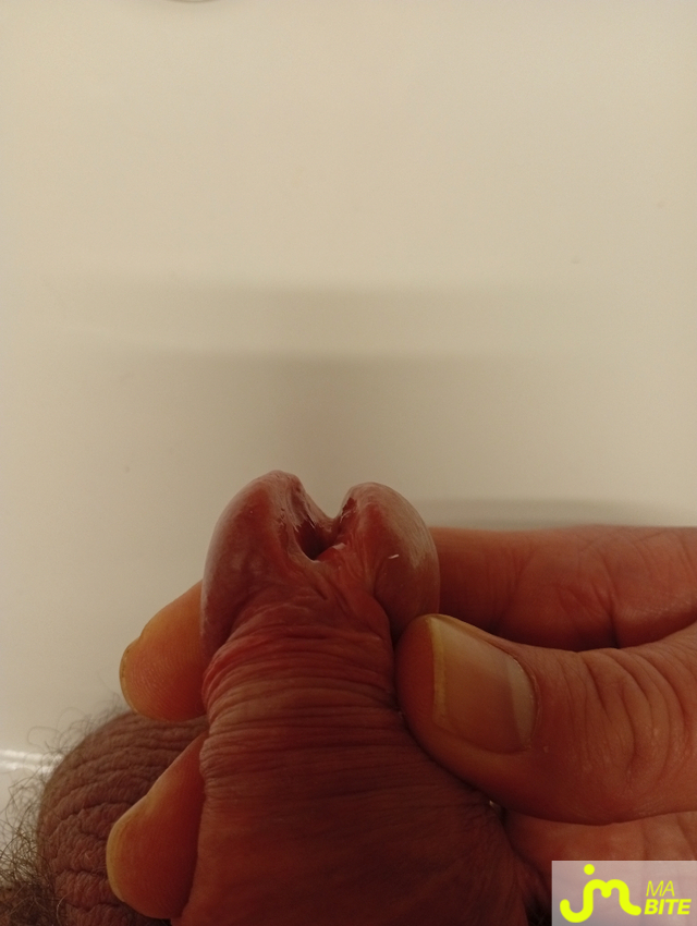 bites de Castration83