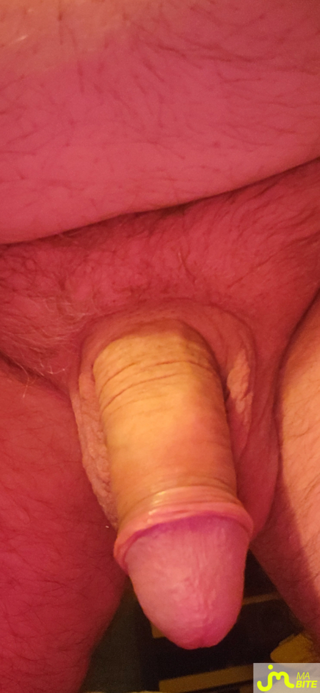 bites de murbitemole