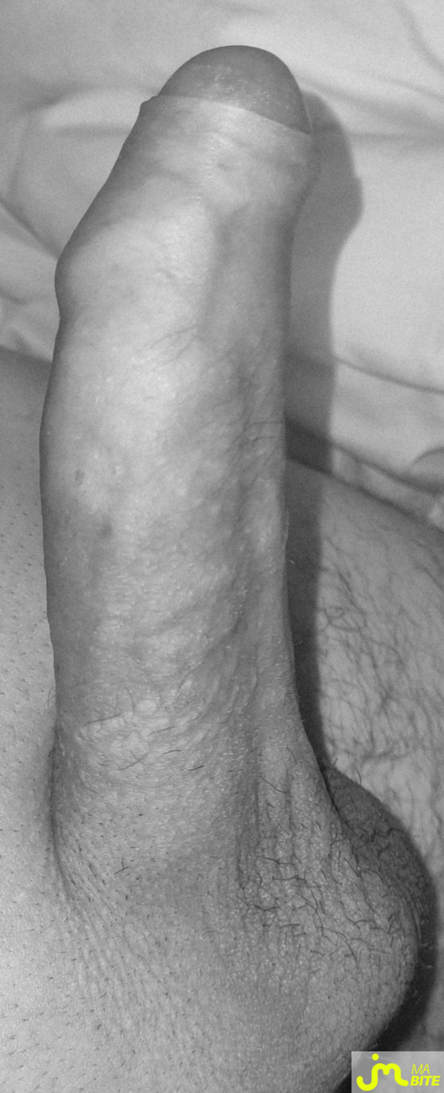 bites de coquindu766