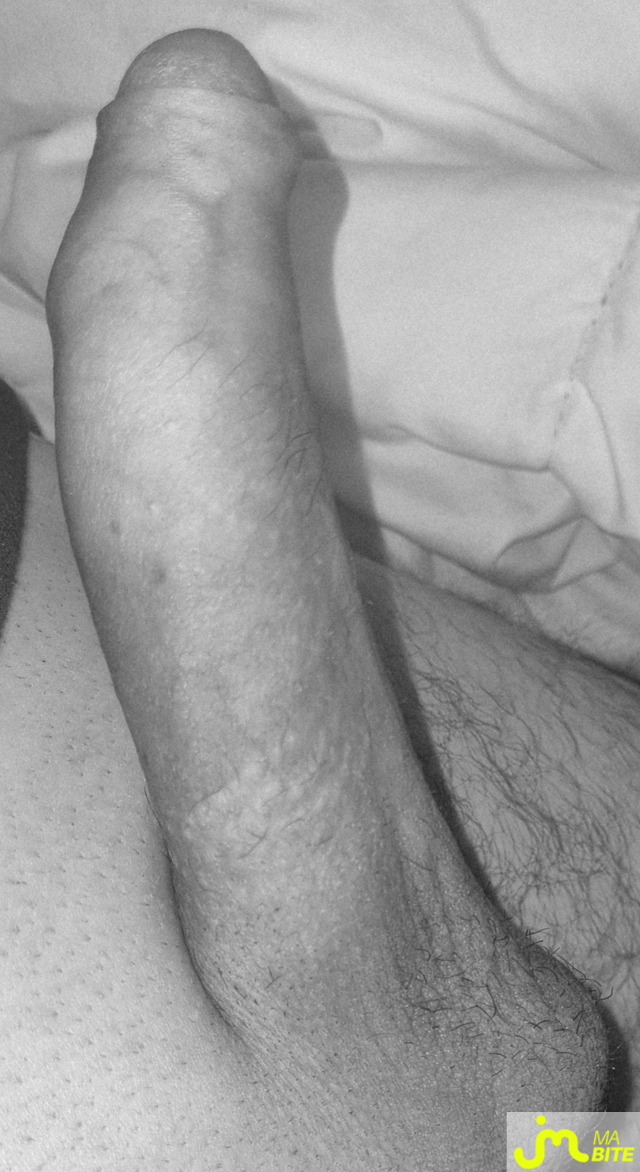 bites de coquindu766