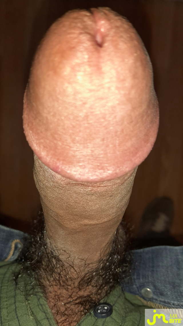 bites de Ericoup&eacute; 