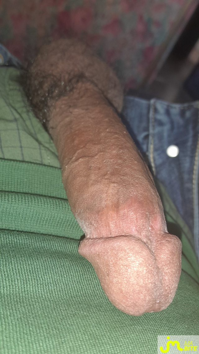 bites de Ericoup&eacute; 