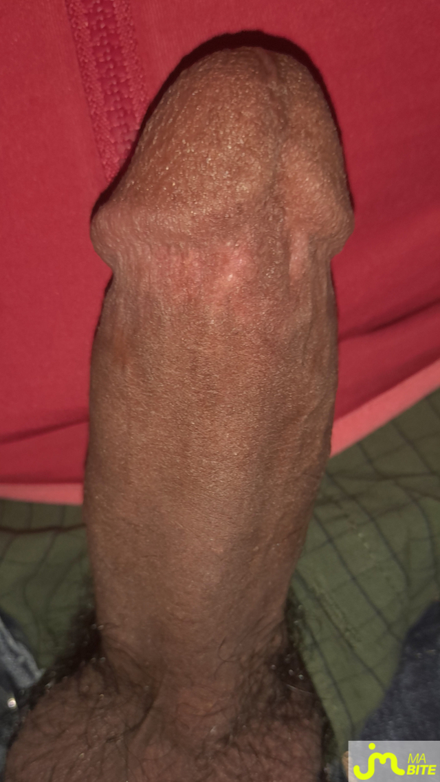 bites de Ericoup&eacute; 