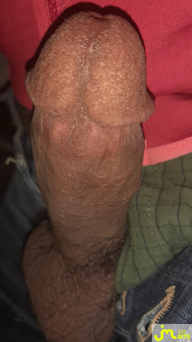 bites de Ericoup&eacute; 