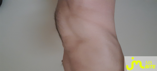 bites de Tibus17 