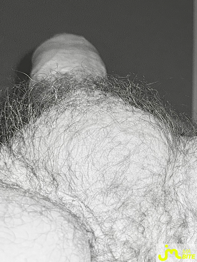 bites de Suceusedu31