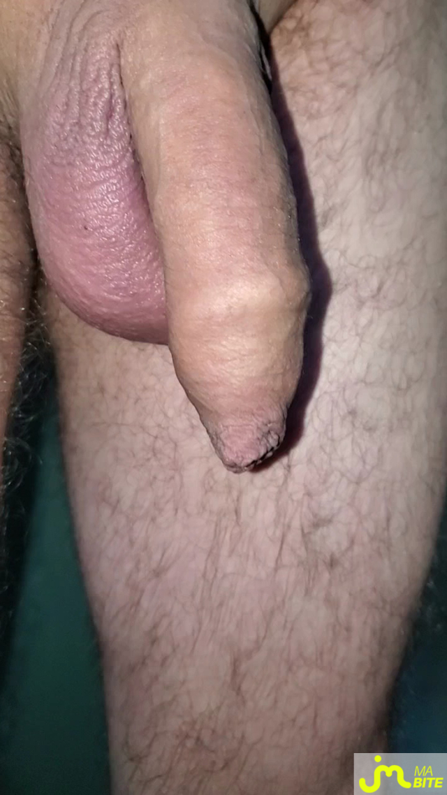 bites de Queute19