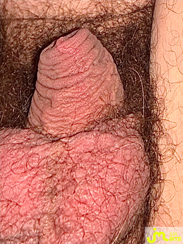 bites de Suceusedu31