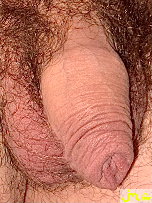 bites de Suceusedu31