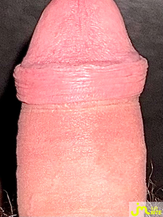 bites de Suceusedu31