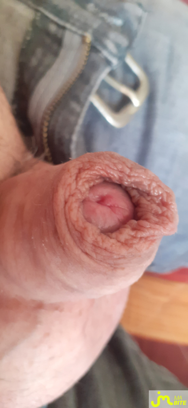 bites de denis 38000
