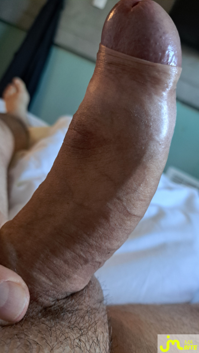 bites de Kogat34gmail