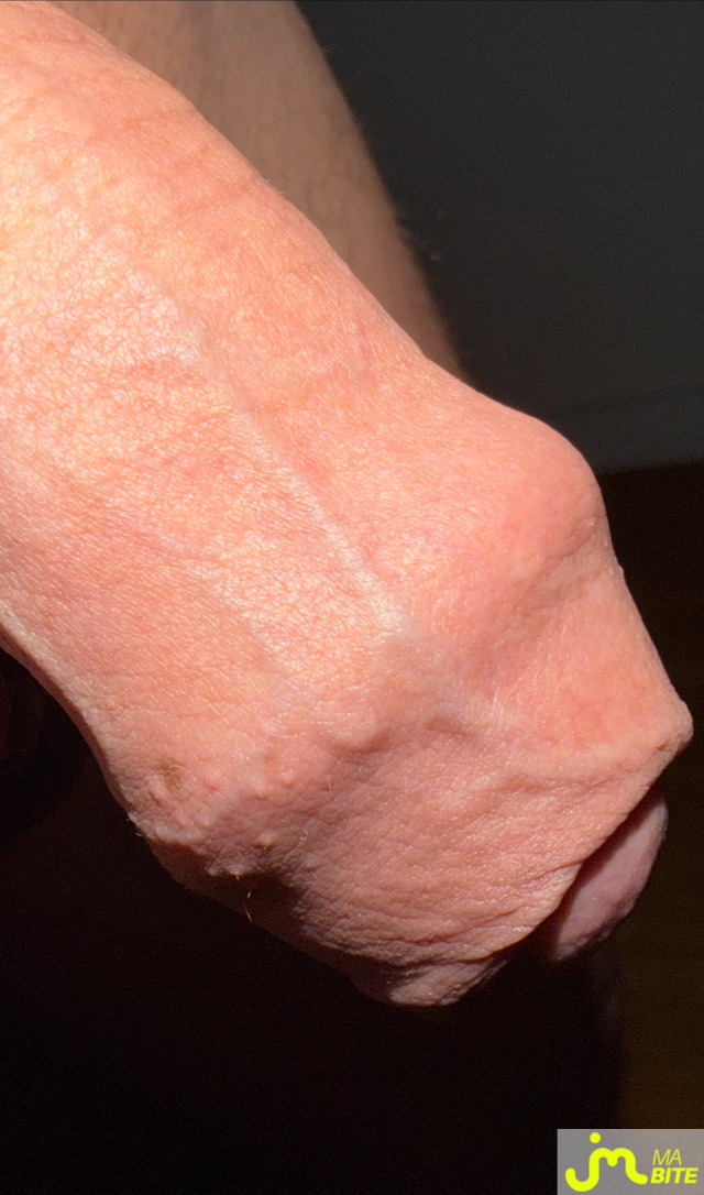 bites de pulpf