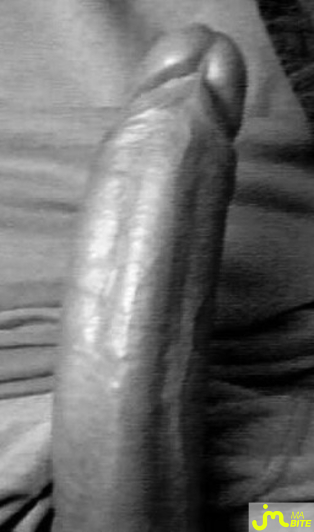 bites de lust4e