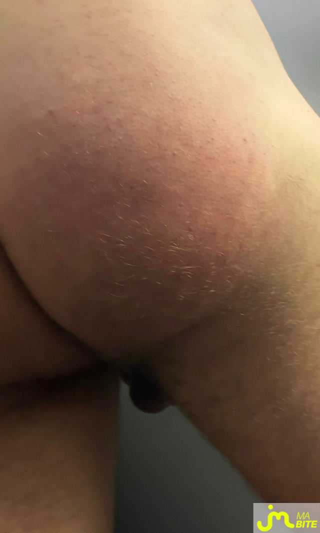 bites de Mau6950