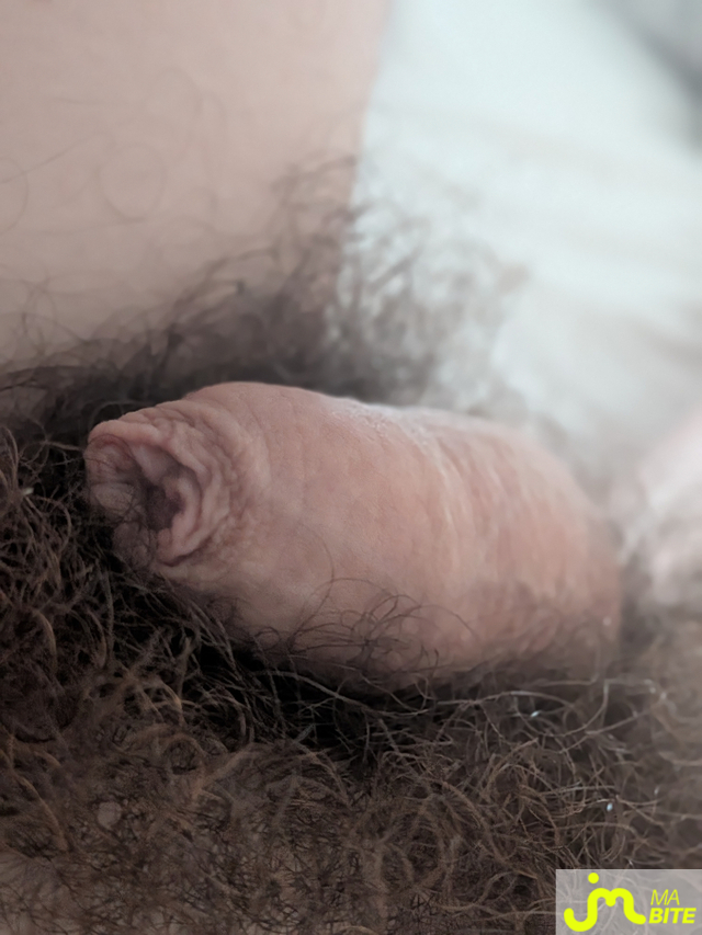 bites de Lucius