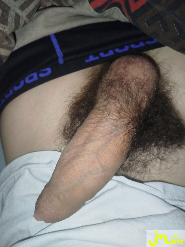 bites de Maxdecm