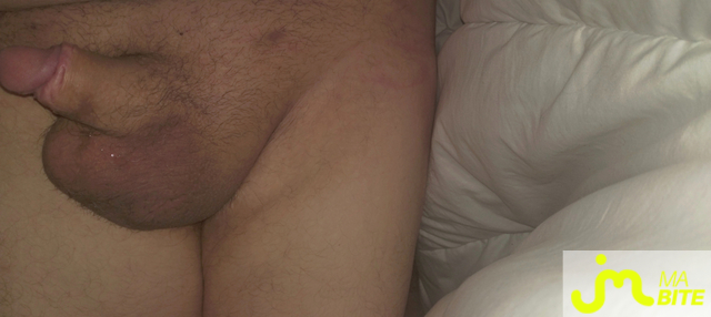 Photos de bites : Le retour