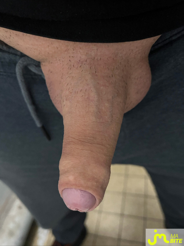 bites de Mecdu93220
