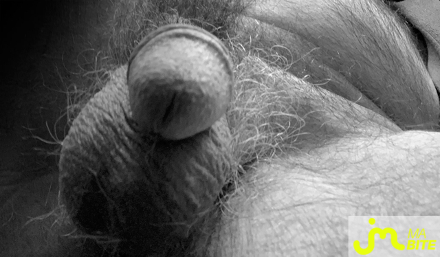 bites de Icke