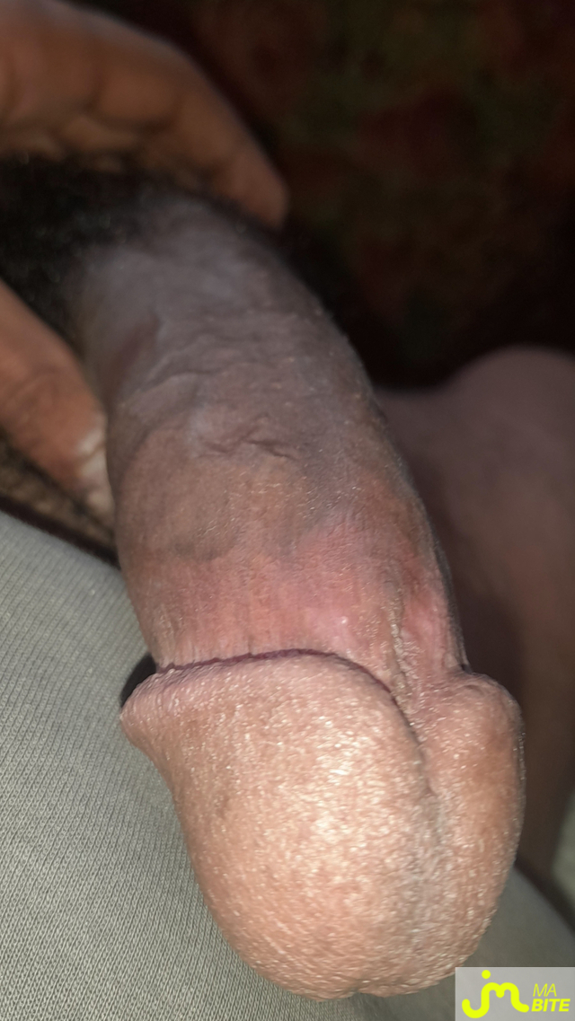 bites de &Eacute;ricleblackandwhite
