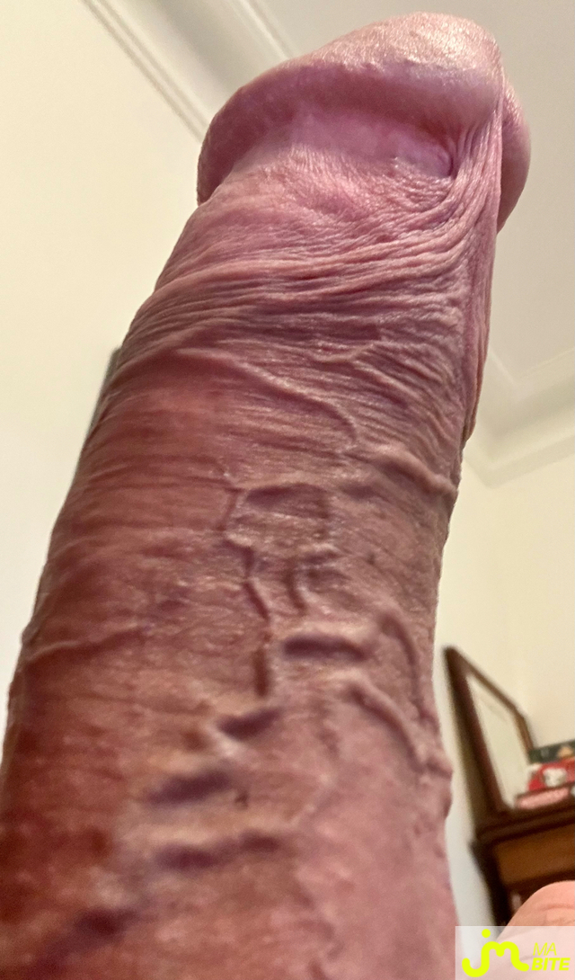 bites de Tomcat
