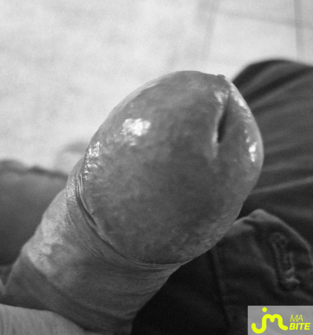 bites de Happybite