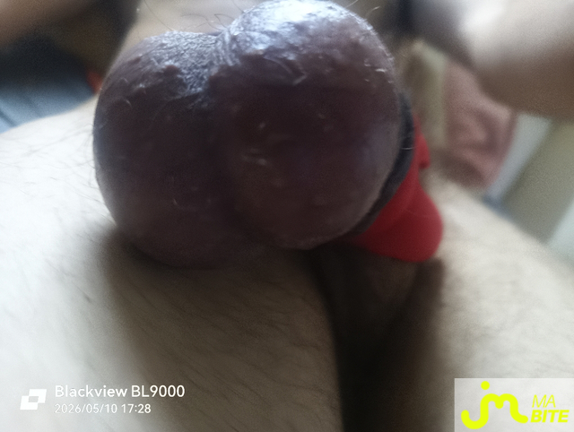 bites de &Eacute;tirement boules